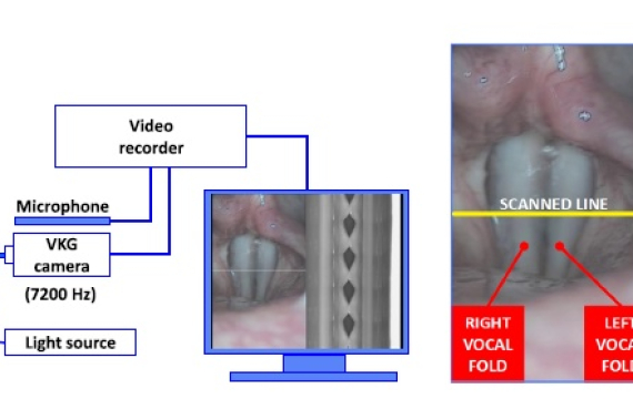 Videokymogram Analyzer Tool: Human–computer comparison