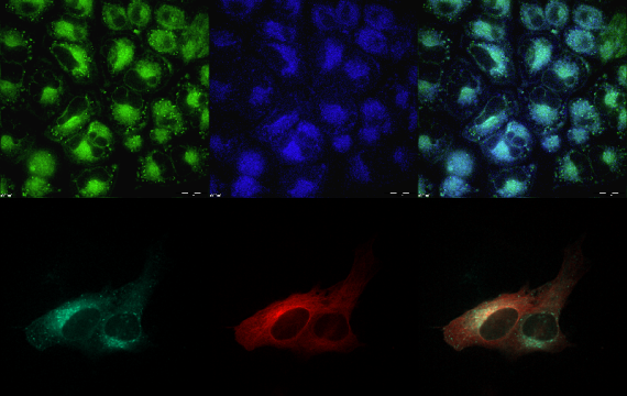 Multimodal data fusion for visualization of applied substances in cells