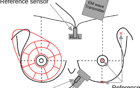 Software for Monitoring Coverage in Hand-Held Whole-Breast Ultrasound