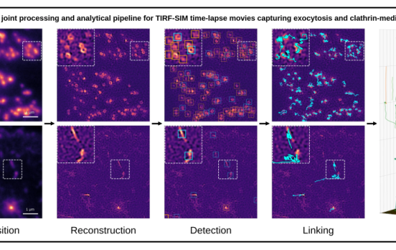 Friday Seminars: Automated Tracking and Analysis of Plasma Membrane Dynamics in TIRF-SIM