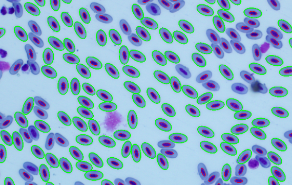 Detection of Avian Red Blood Cells
